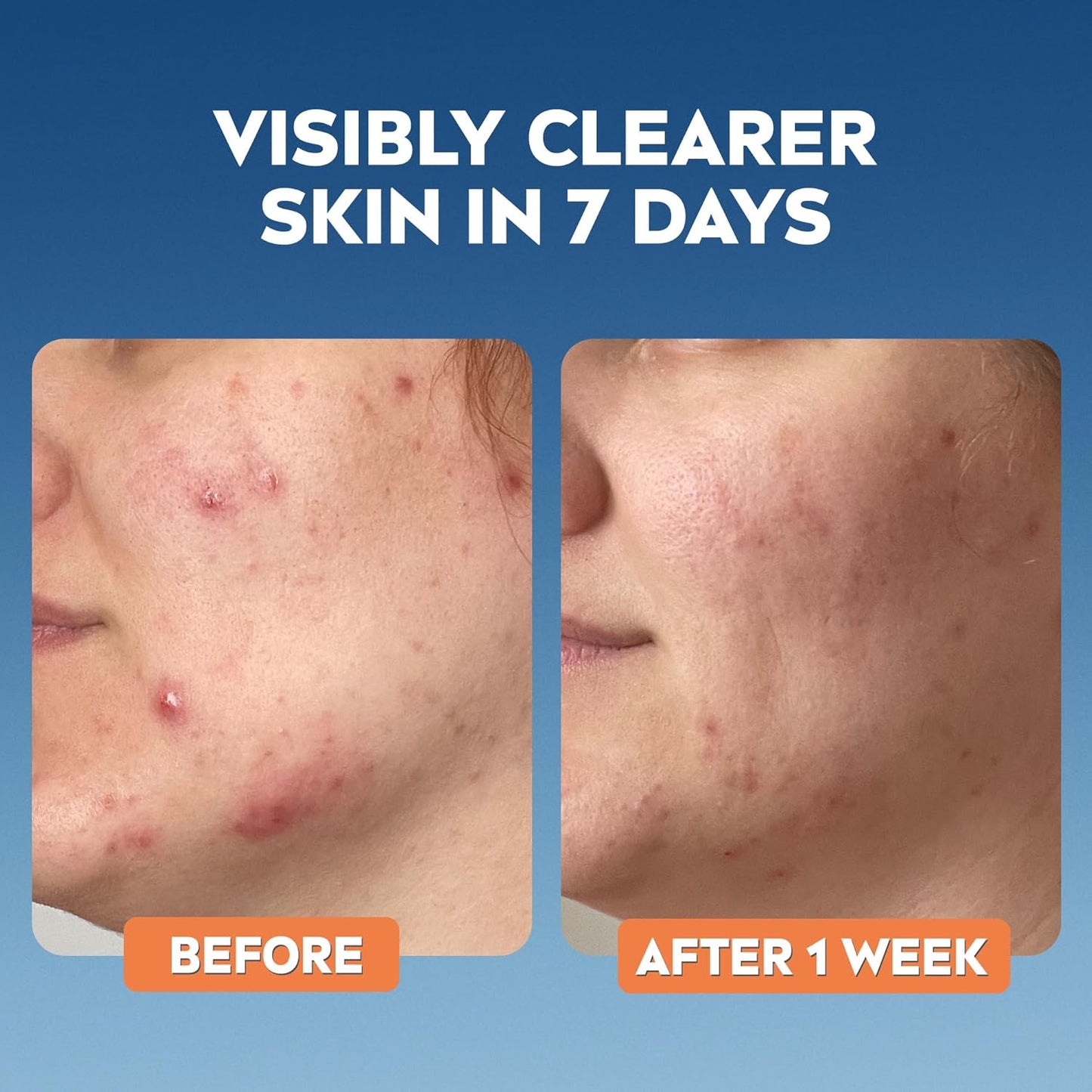 Derma Skin Clear Toner (200Ml)